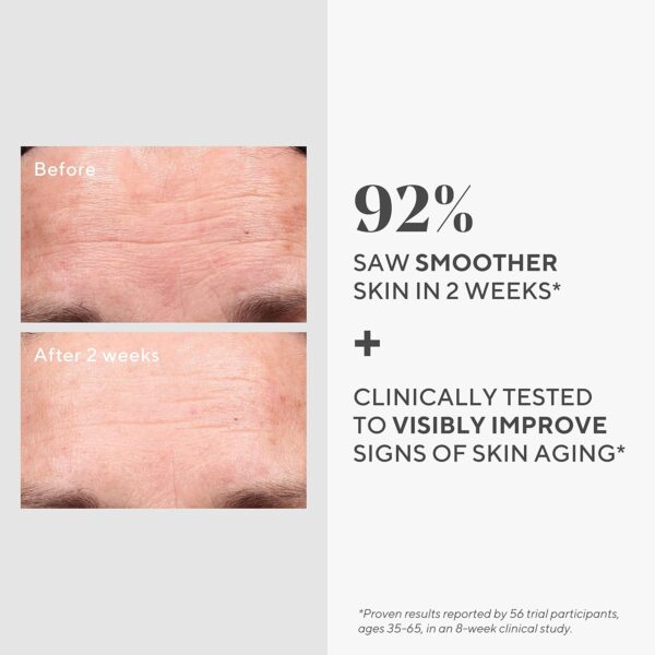 AMAZON Big Spring Deal -20% Murad Retinol Youth Renewal Serum - Image 3